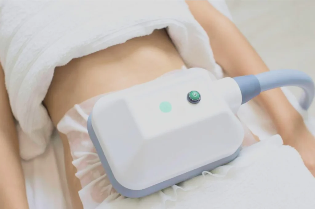 How Fat Freezing and HIFU Work Together? 3 advantages to combining Fat Freezing and HIFU Leeds