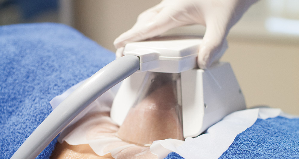 How Fat Freezing and HIFU Work Together? 2 Multiple Areas in One Session HIFU and Fat Freezing Leeds